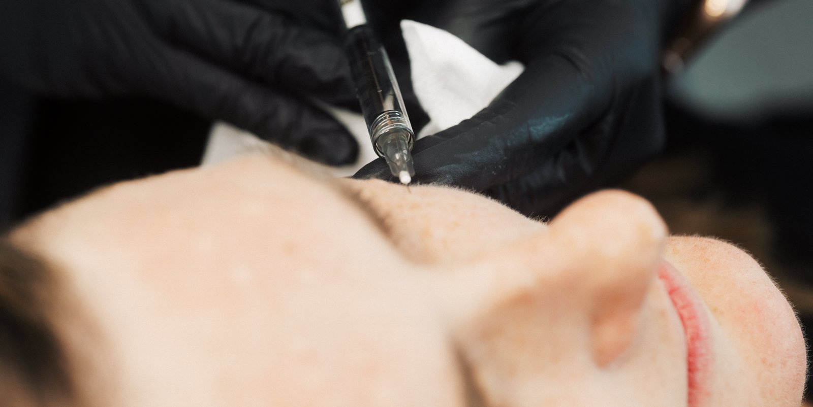 Dr Lauren injecting a patient's cheek area with Botox.