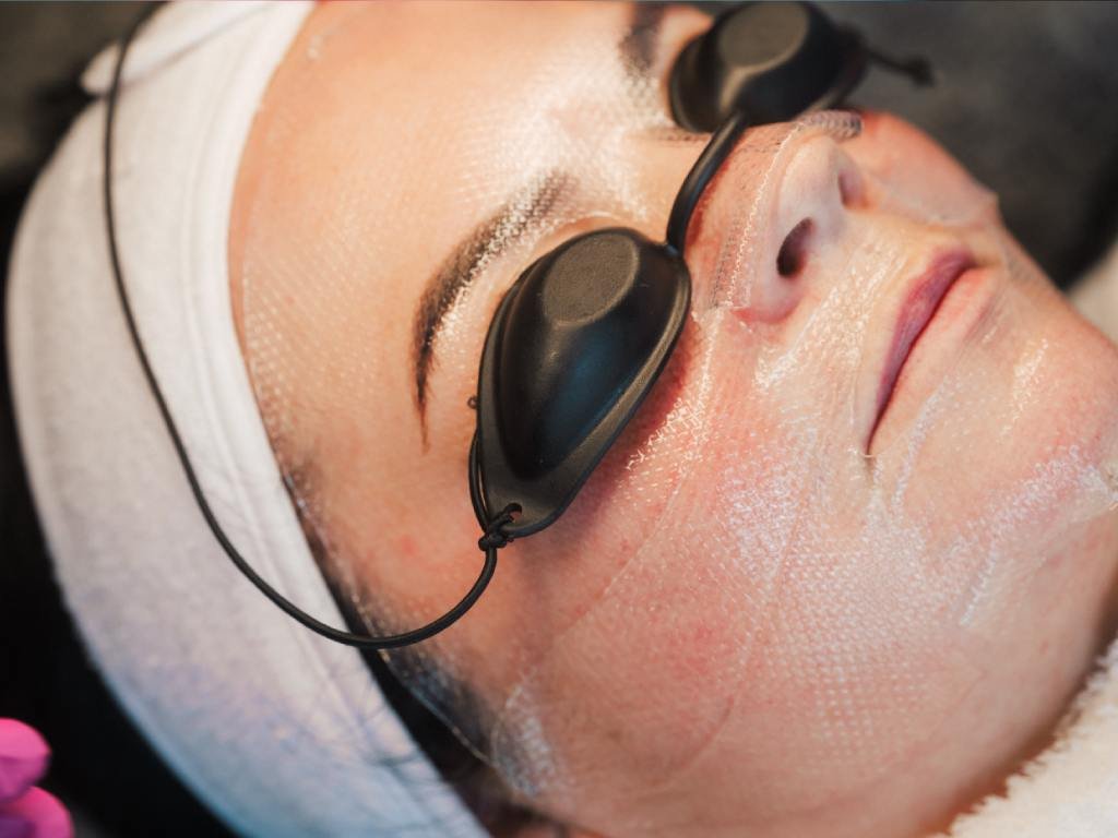 A patient with safety goggles covering her eyes and a face mask to treat rosacea.