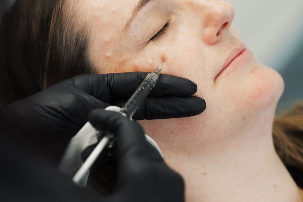 Dr. Lauren injecting a patient's cheek.
