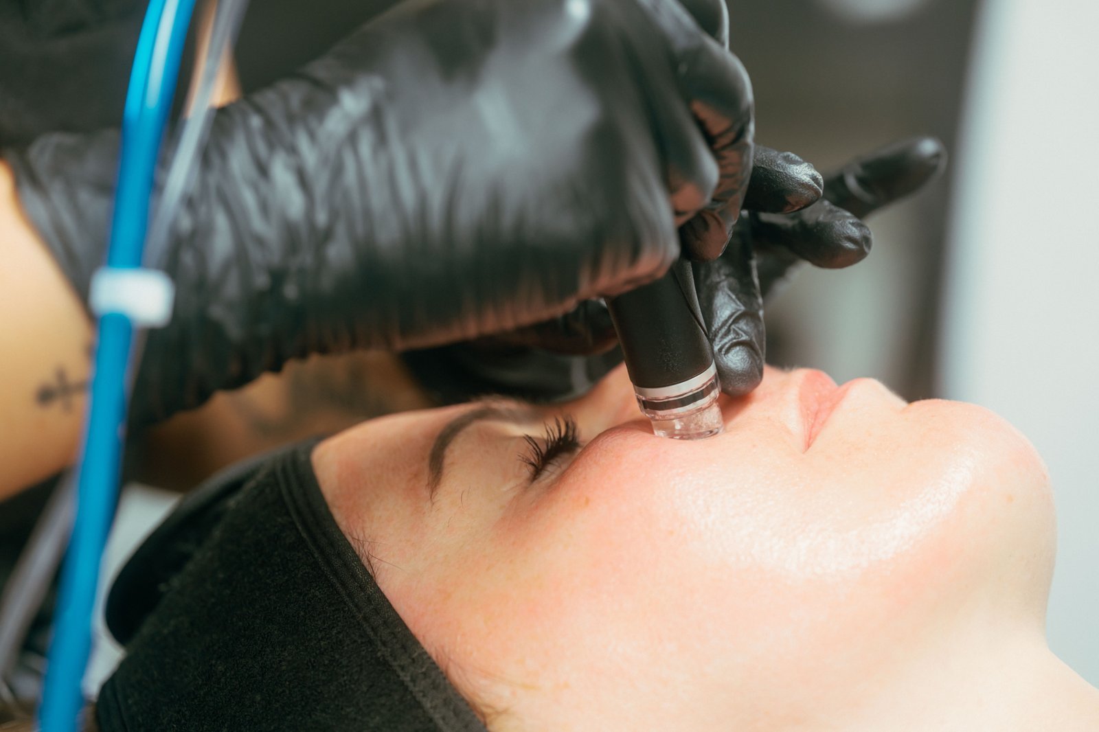 Dr Lauren's Skin Therapist delivering Hydrafacial to a patient's face.