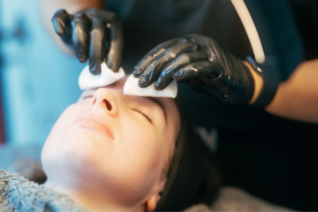 Dr Lauren's Skin Therapist preparing a patient's face for microneedling.