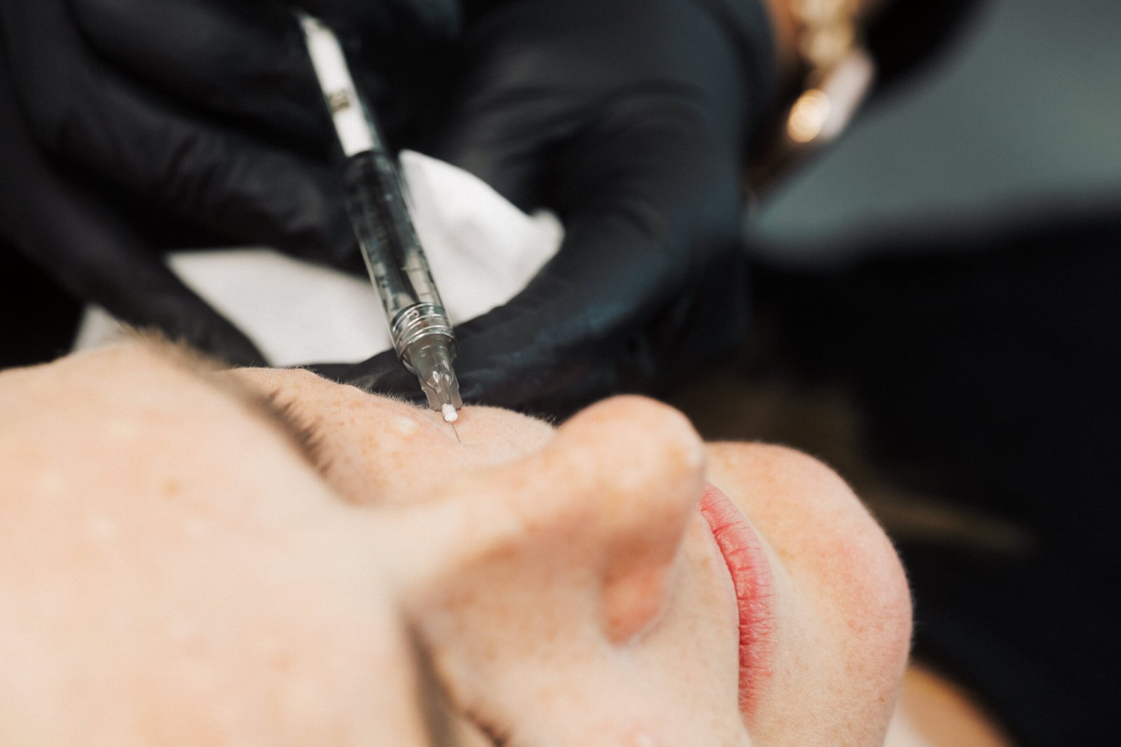 A patient getting aesthetic fillers at Dr Lauren's clinic.