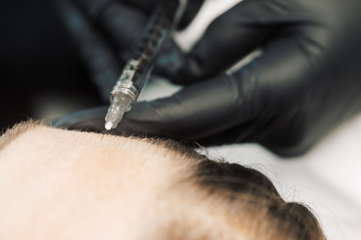 Dr Lauren injecting a patient's forehead with Botox.