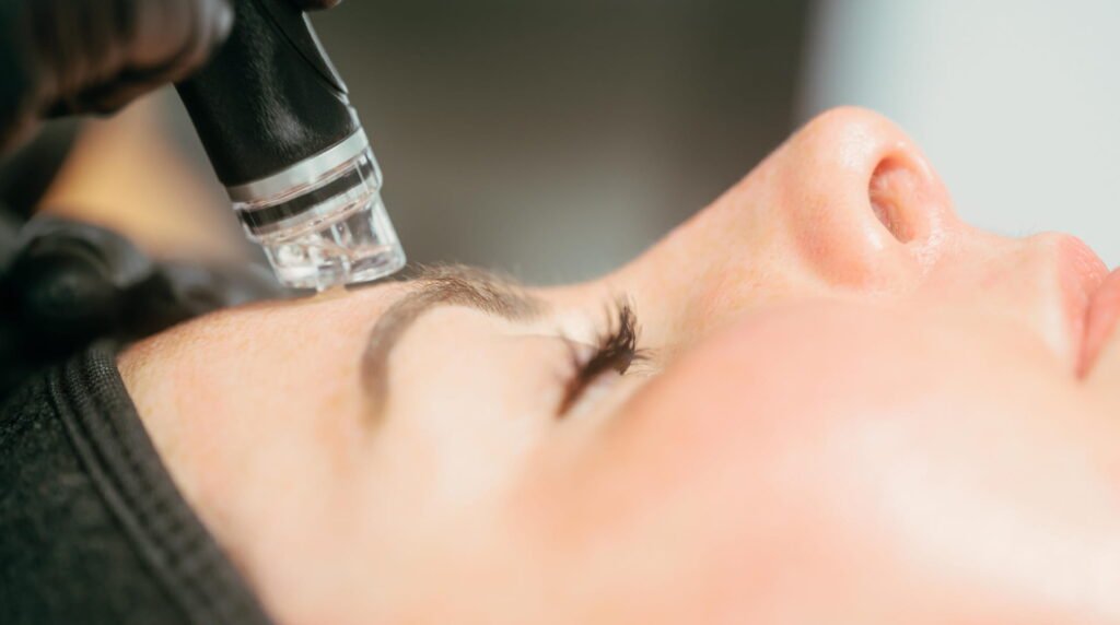 A Hydrafacial treatment being administered by a Skin Therapist at Dr Lauren’s clinic.