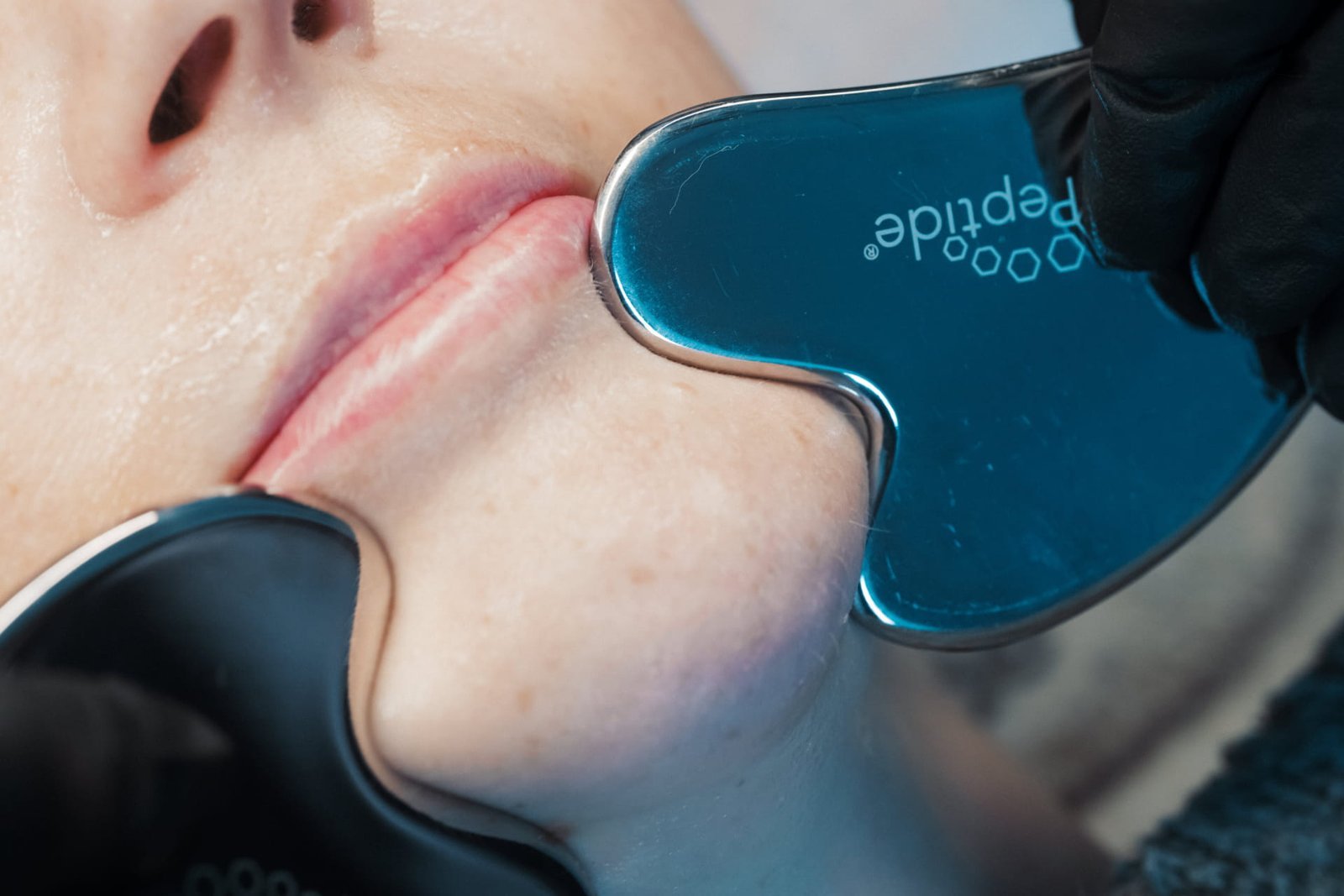 A Skin Therapist at Dr Lauren's clinic using HydroPeptide's guasha tools on a patient's face.