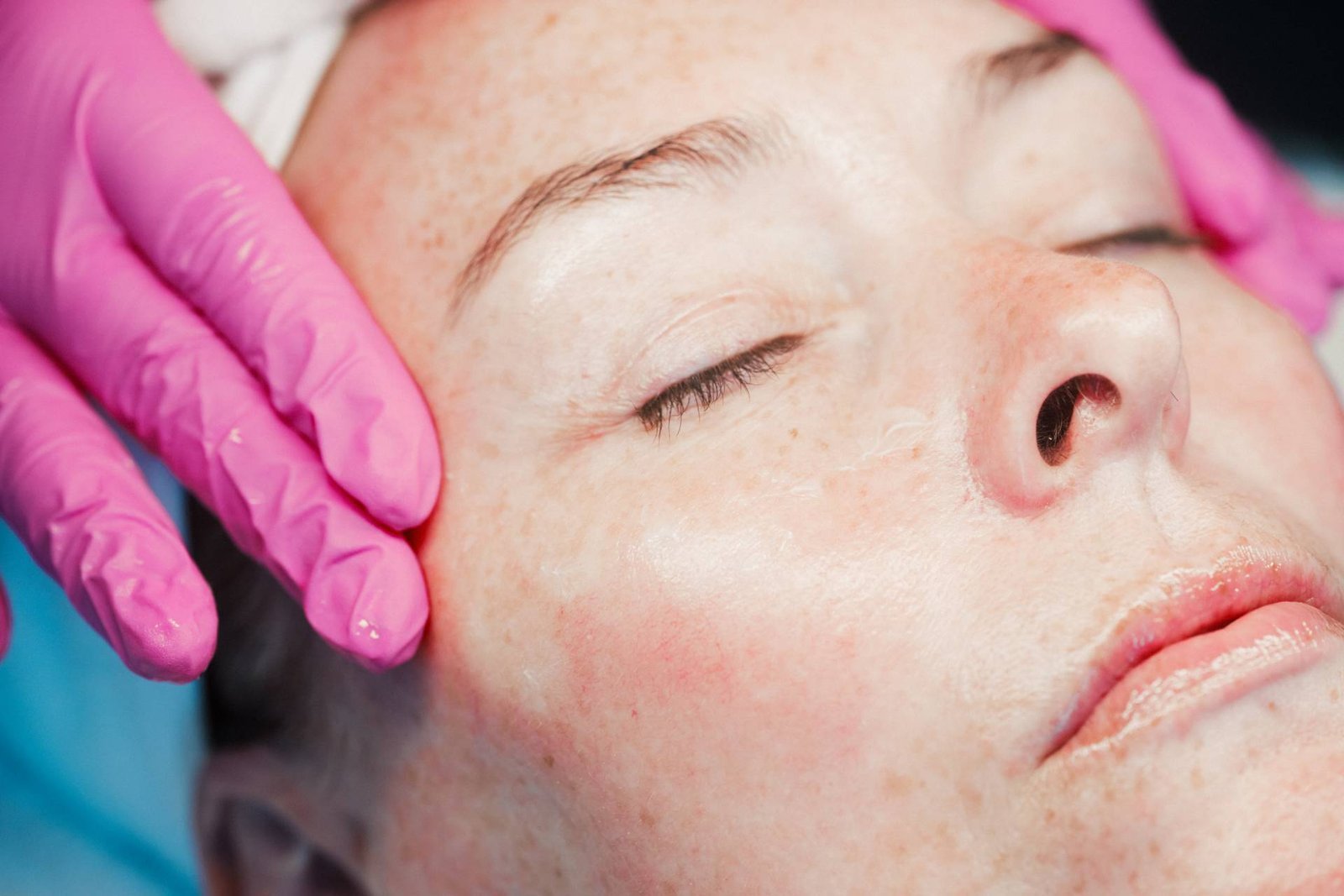 A patient at Dr Lauren's clinic ready for an aesthetic treatment.